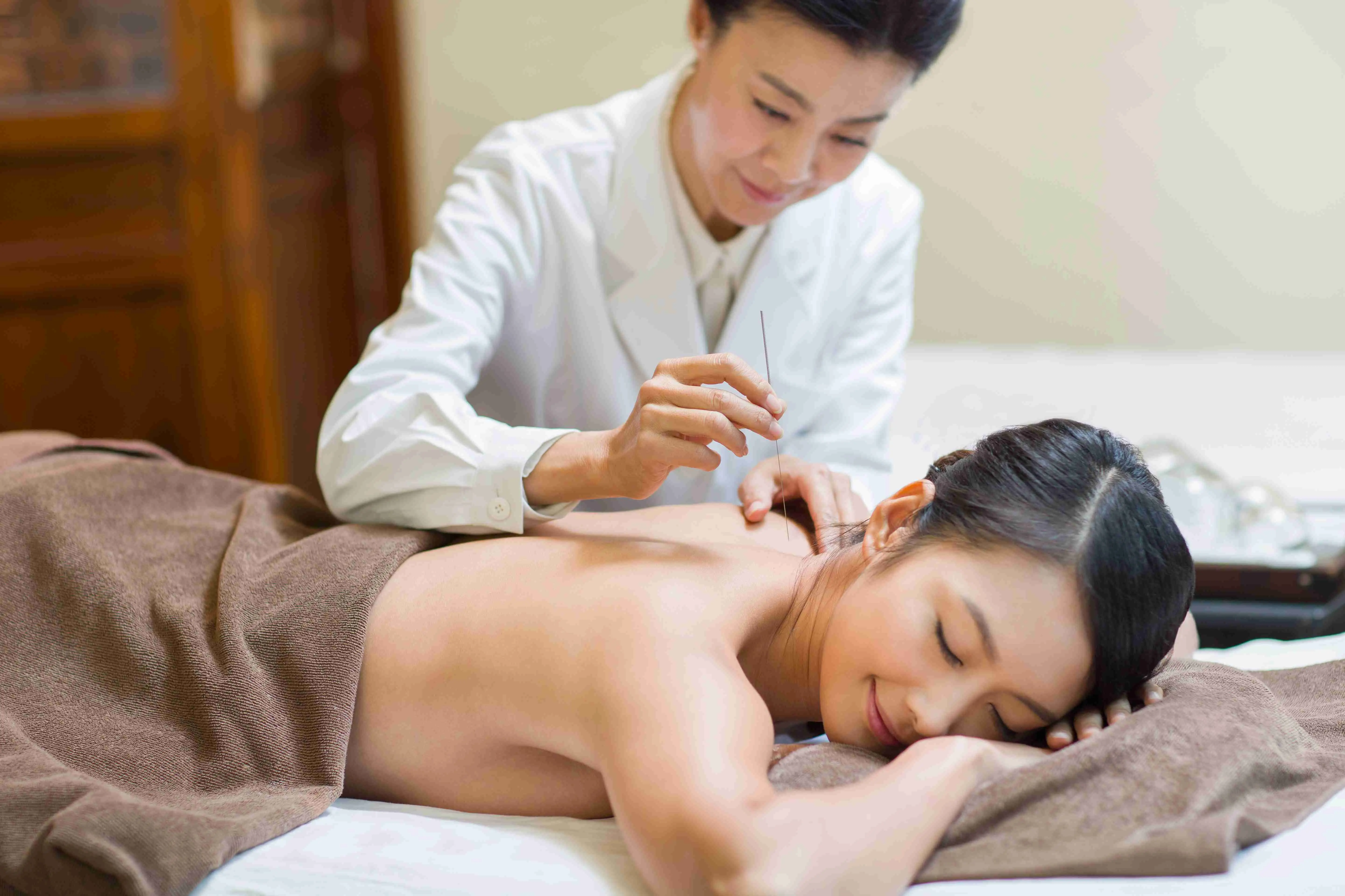 Young Chinese woman receiving acupuncture