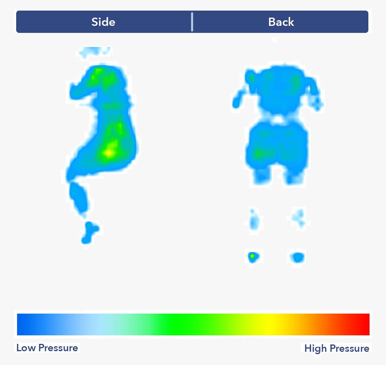 Pressure map shown all blue pressure points