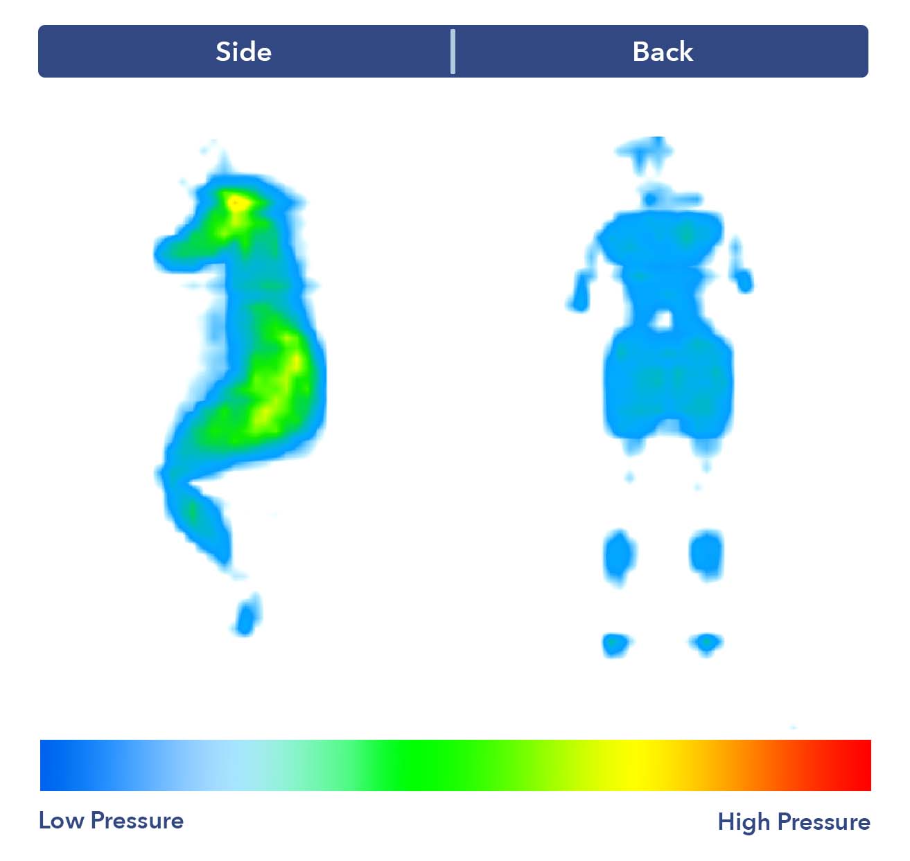 Pressure map shown all blue pressure points