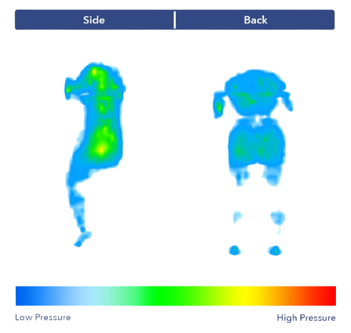 Pressure map shown all blue pressure points