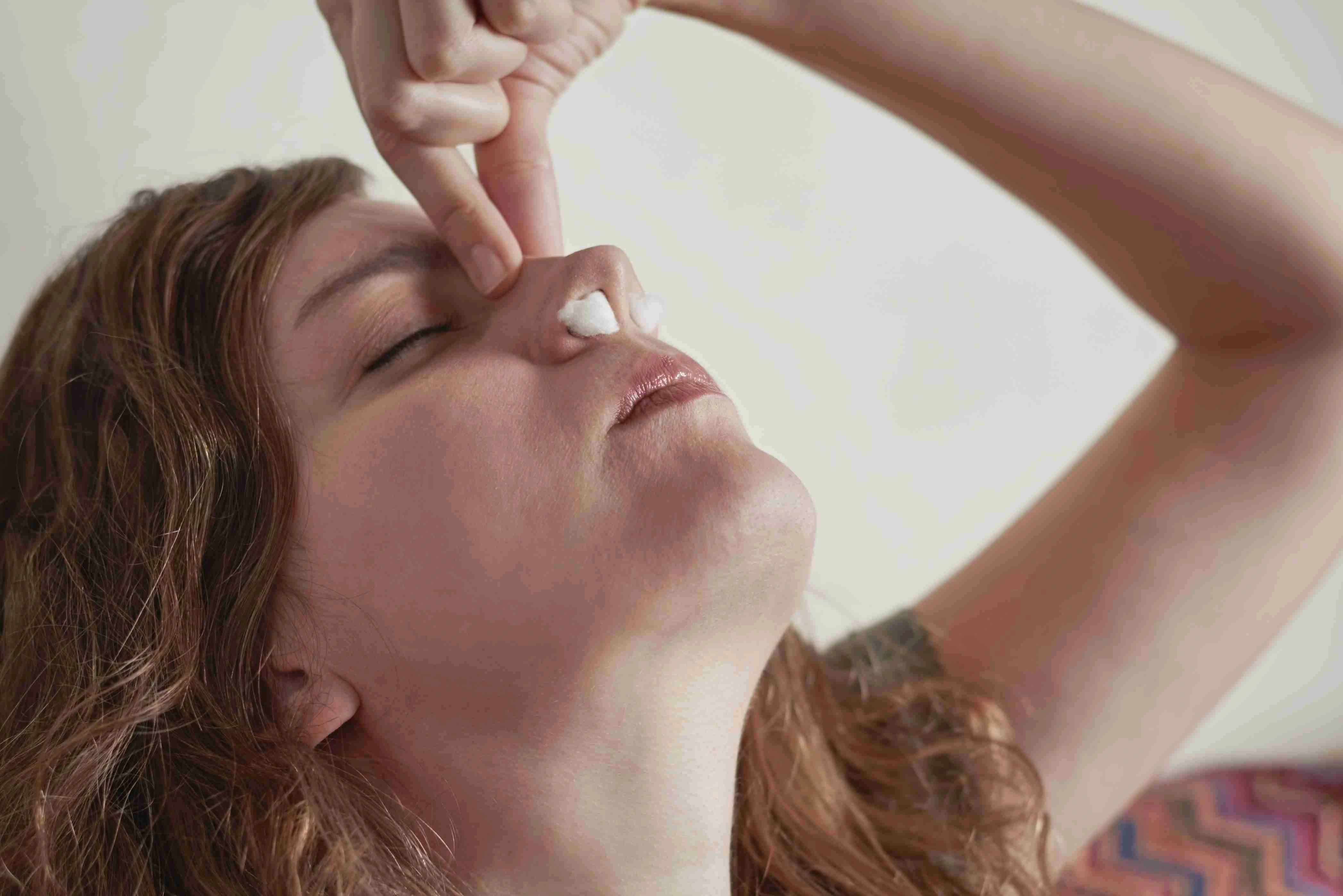 Woman suffer from the nose bleeding
